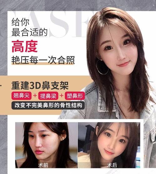 网红打造整形,揭秘网红打造完美形象的蜕变之路
